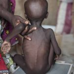 Nigeria Must Address Malnutrition, 2,400 Children Die Daily – UNICEF